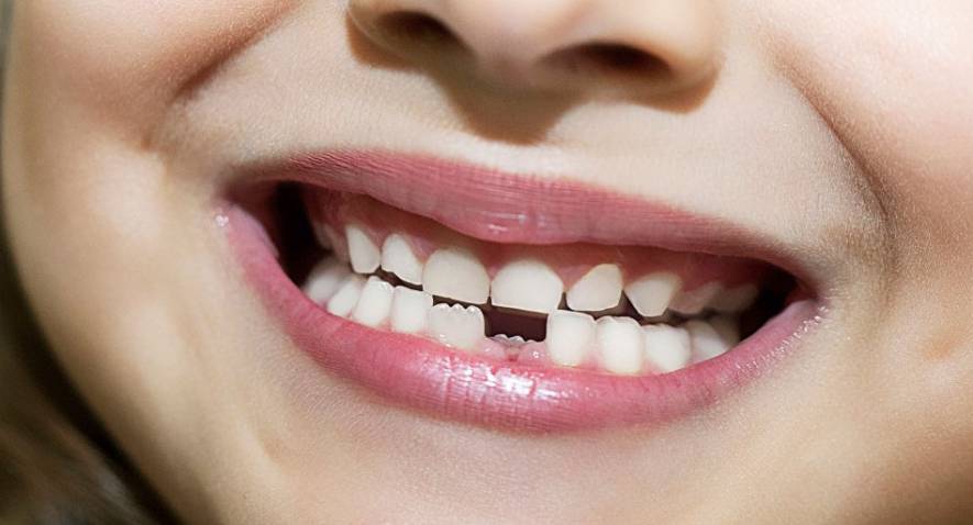 Comment nos enfants peuvent en apprendre sur leurs dents