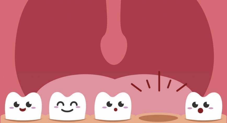 Vos dents : types, rôles et tout ce que vos enfants doivent savoir